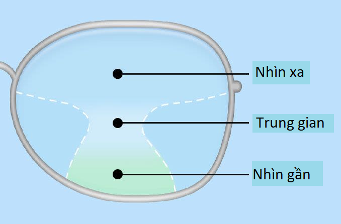 Tư vấn về kính đa tròng tại Sóc Trăng — Mắt kính Đức Phương Sóc Trăng