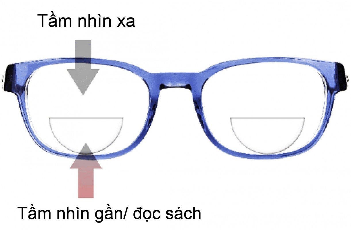 Tư vấn về kính đa tròng tại Sóc Trăng — Mắt kính Đức Phương Sóc Trăng