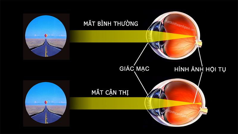 Bước 2: — Mắt kính Đức Phương Sóc Trăng