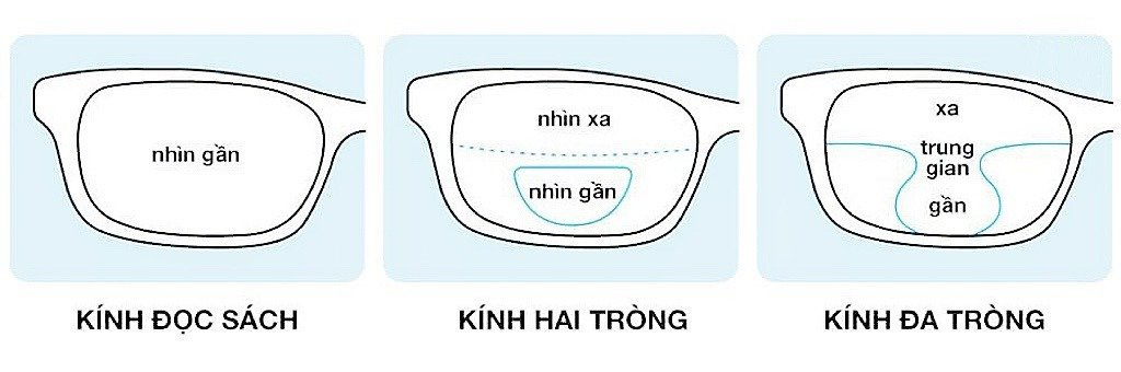 Tư vấn về kính đa tròng tại Sóc Trăng — Mắt kính Đức Phương Sóc Trăng