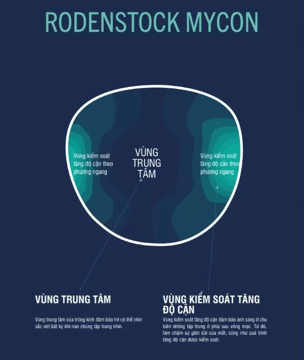 MyCon hoạt động như thế nào — Mắt kính Đức Phương Sóc Trăng