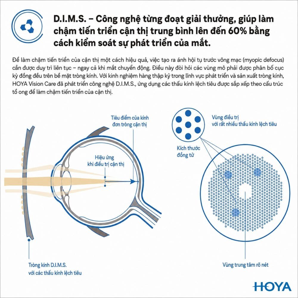 Sơ đồ công nghệ D.I.M.S. trên tròng kính HOYA MiYOSMART với các thấu kính lệch tiêu xếp theo cấu trúc tổ ong